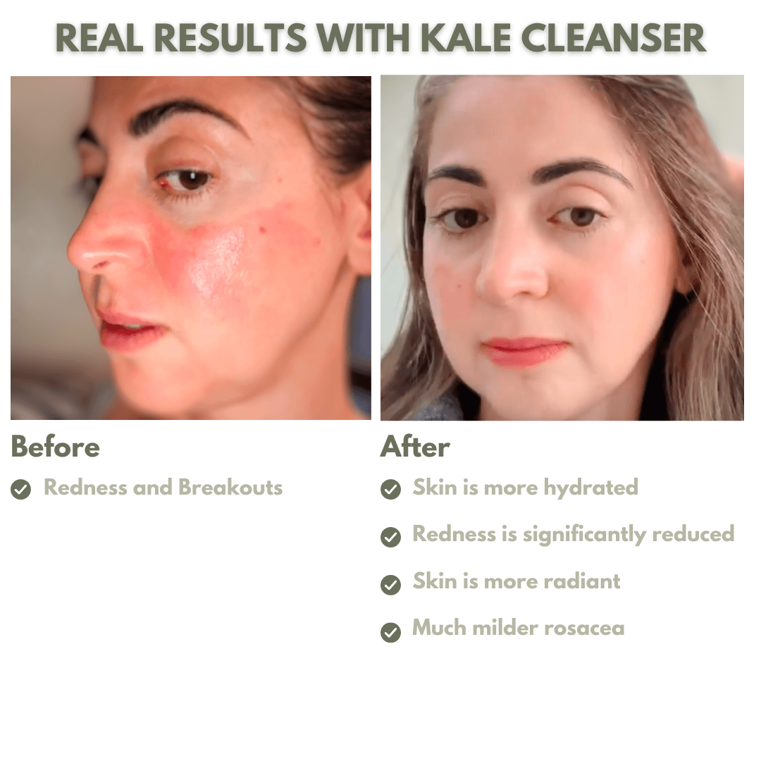 90 Days Supply - Kale Cleanser