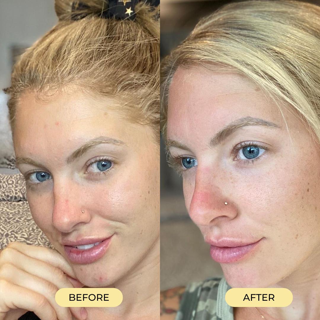 before and after skincare