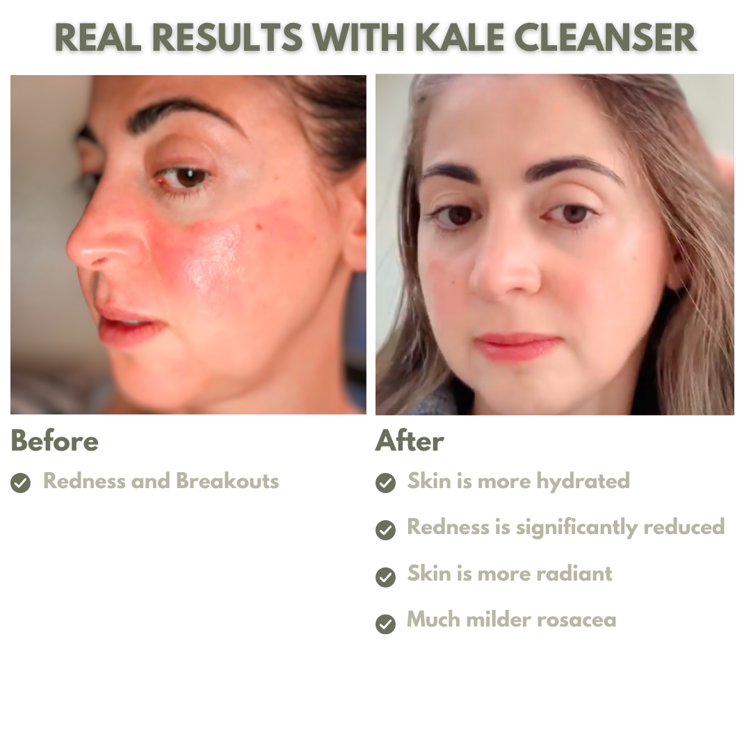 Ayurvedic Glow Boost