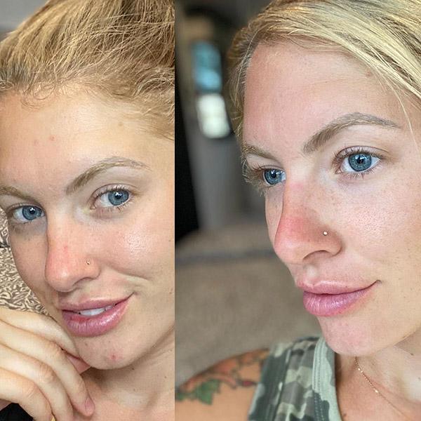 Before and After